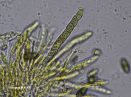 Attēlu rezultāti vaicājumam “Calicium viride”