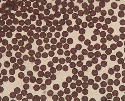 Attēlu rezultāti vaicājumam “Badhamia lilacina spores”