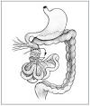 <b>Volvulus</b> Pictures