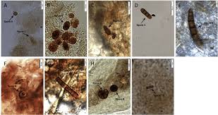 Attēlu rezultāti vaicājumam “Enteridium corticatum spores”