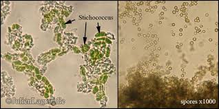Attēlu rezultāti vaicājumam “Chaenotheca trichialis”