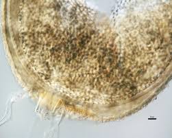 Attēlu rezultāti vaicājumam “Leptobryum pyriforme sporophyte”