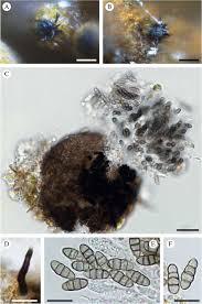 Attēlu rezultāti vaicājumam “Lichenoconium xanthoriae”