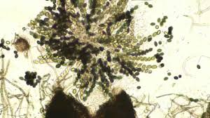 Attēlu rezultāti vaicājumam “Sordaria fimicola”