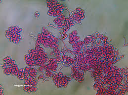 Attēlu rezultāti vaicājumam “Illosporiopsis christiansenii”
