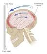 Traumatic brain injury - Wikipedia, the free encyclopedia