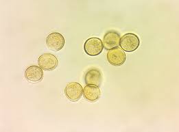 Attēlu rezultāti vaicājumam “Trichia contorta”