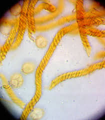 Attēlu rezultāti vaicājumam “Oligonema affine”