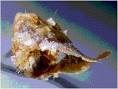 Ear wax