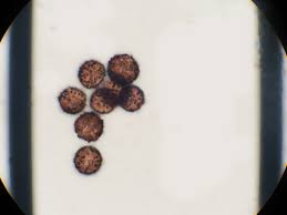 Attēlu rezultāti vaicājumam “Diderma cinereum spores”