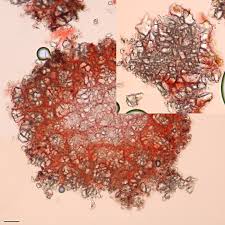 Attēlu rezultāti vaicājumam “Stictis”