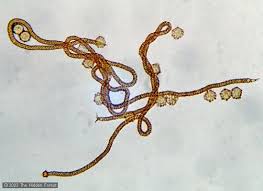 Attēlu rezultāti vaicājumam “Oligonema sp.”