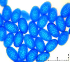 Attēlu rezultāti vaicājumam “Sowerbyella radiculata”