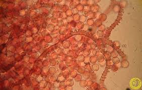 Attēlu rezultāti vaicājumam “Arcyria minuta”