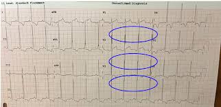 Image result for  ^ L V [ h    