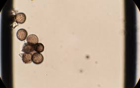 Attēlu rezultāti vaicājumam “Didymium megalosporum spores”