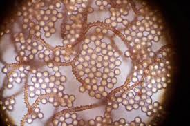 Attēlu rezultāti vaicājumam “Arcyria affinis capillitium”