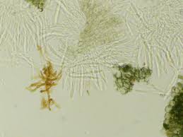 Attēlu rezultāti vaicājumam “Mollisia uda”