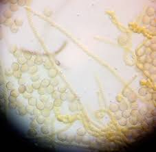 Attēlu rezultāti vaicājumam “Hemitrichia leiotricha”
