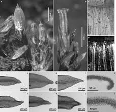 Attēlu rezultāti vaicājumam “Orthotrichum patens sporophyte”