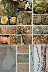 Attēlu rezultāti vaicājumam “Heterotrichia oerstedii (syn. Arcyria oerstedii) spores”