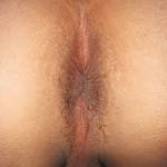 File:Male anus.jpg - Wikimedia Commons