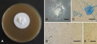 Attēlu rezultāti vaicājumam “Badhamia juliae spores”