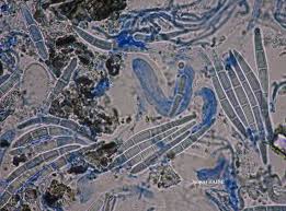 Attēlu rezultāti vaicājumam “Lecanactis abietina”