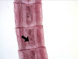 Image result for cestoda excrement dog