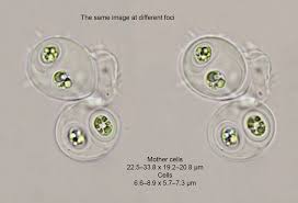 Attēlu rezultāti vaicājumam “Gloeocapsa rupestris”