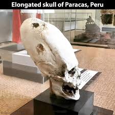 Image result for elongated skulls
