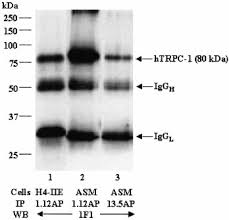 Image result for HTRPC