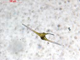 Attēlu rezultāti vaicājumam “Craterium sp.”