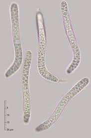 Attēlu rezultāti vaicājumam “Lasiosphaeria ovina”