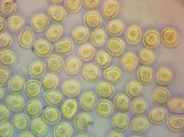 Attēlu rezultāti vaicājumam “Lycogala cf. oleocrystalliferum”