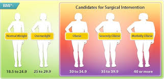 Bildresultat för bmi-tabell