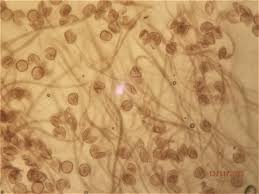 Attēlu rezultāti vaicājumam “Lamproderma violaceum”