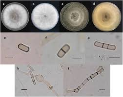 Attēlu rezultāti vaicājumam “Dianema nivale spores”