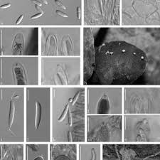 Attēlu rezultāti vaicājumam “Hymenoscyphus fructigenus var. coryli”