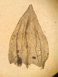 Attēlu rezultāti vaicājumam “Sciuro-hypnum reflexum”