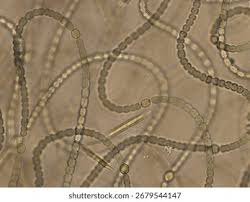 Attēlu rezultāti vaicājumam “Nostoc commune macro”