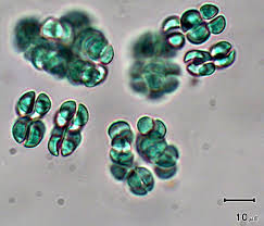 Attēlu rezultāti vaicājumam “Gloeocapsa rupestris”