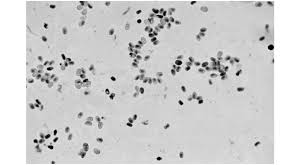Attēlu rezultāti vaicājumam “Badhamia affinis var. microspora spores”