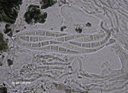 Attēlu rezultāti vaicājumam “Lecanactis abietina”