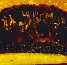 Attēlu rezultāti vaicājumam “Diderma roanense spores”