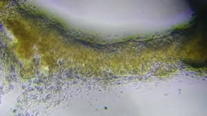 Attēlu rezultāti vaicājumam “Craterium minutum spores”