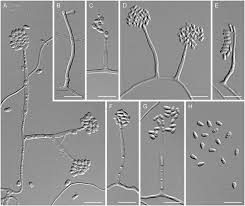 Attēlu rezultāti vaicājumam “Hyaloscypha hyalina”