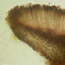 Attēlu rezultāti vaicājumam “Hertelidea botryosa”