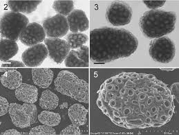 Attēlu rezultāti vaicājumam “Urocystis anemones spores”