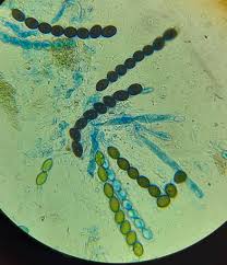 Attēlu rezultāti vaicājumam “Sordaria fimicola”